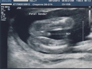 Baby gender.  It's a BOY!